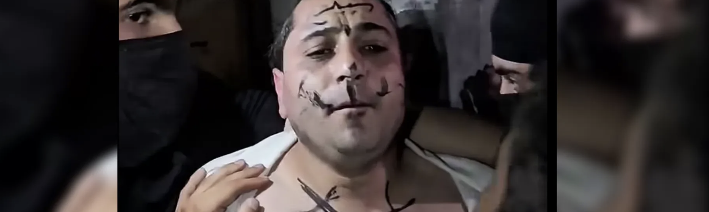 اعتداء على فنان سوري.. قصوا شعره وكتبوا على وجهه