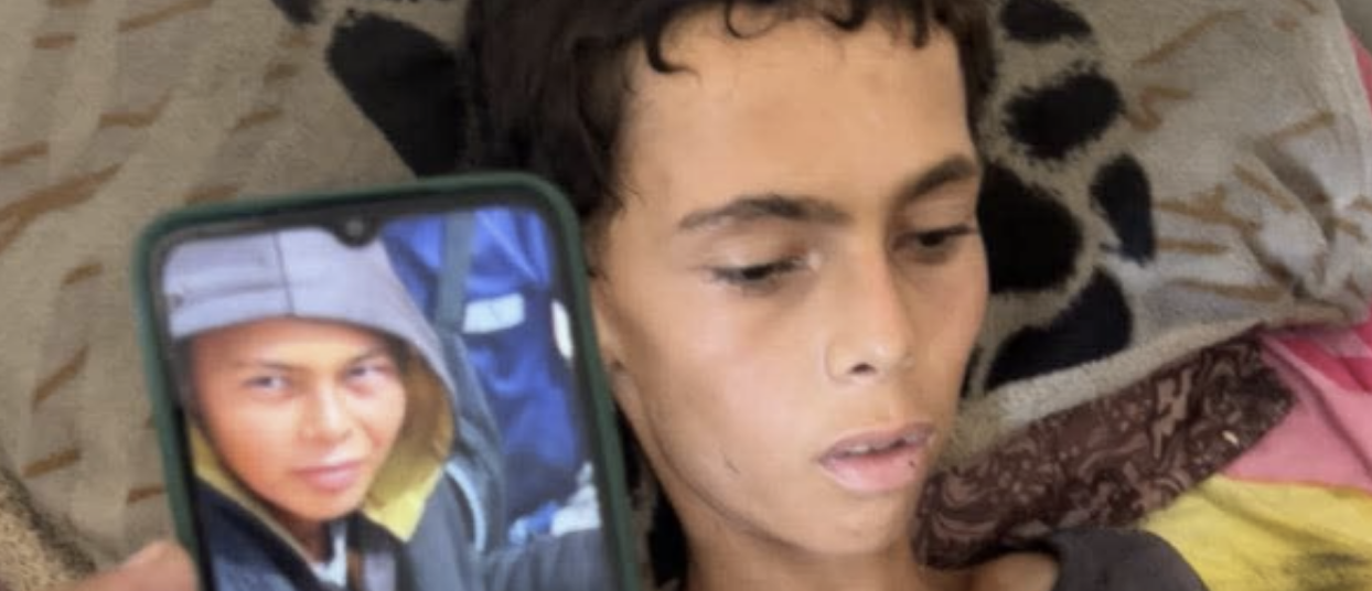 وفاة فتى بسبب سوء التغذية والمجاعة في غزة