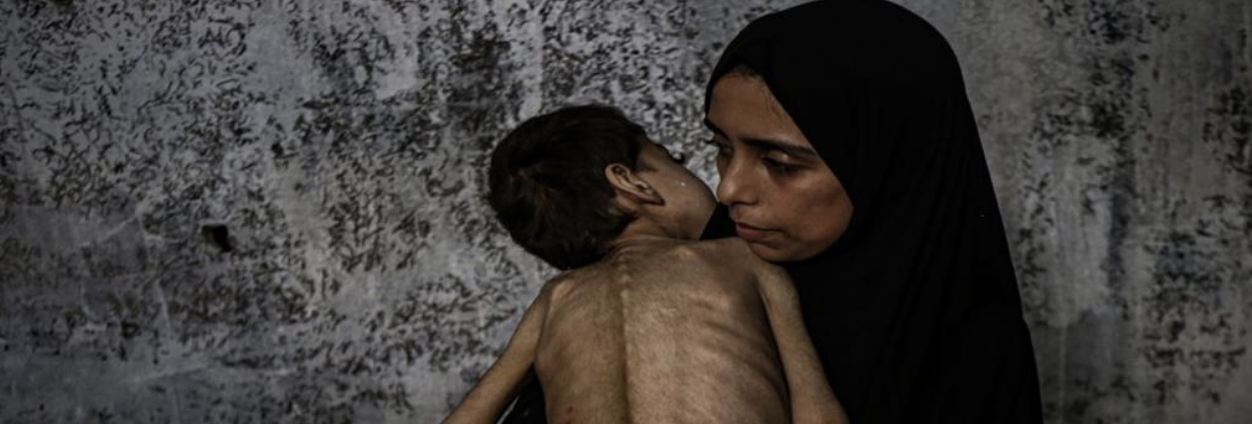 4 وفيات نتيجة المجاعة وسوء التغذية خلال الـ24 ساعة الماضية في قطاع غزة