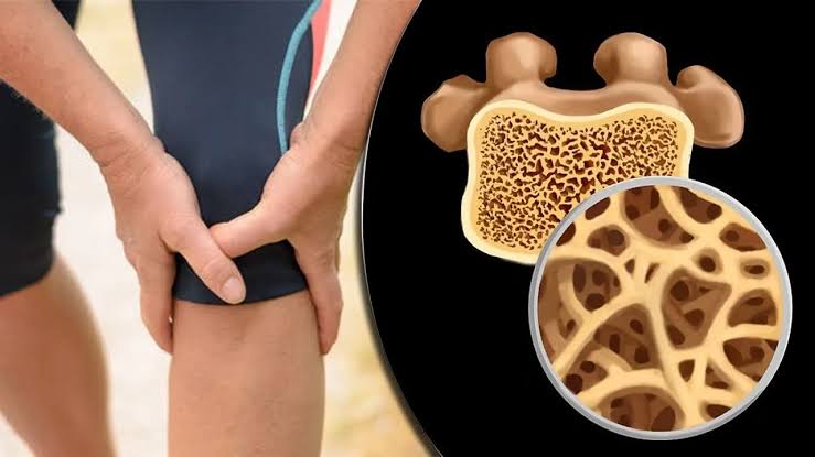 لا تنتظر الكسر.. الدم يخبرك أولًا