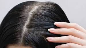 أسرار الشيب المبكر وكيفية الحد منه