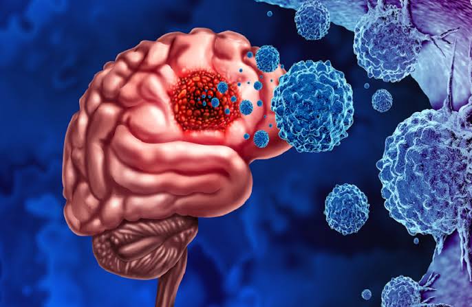 أقراص غذائية بسيطة قد تكبح أخطر أورام الدماغ