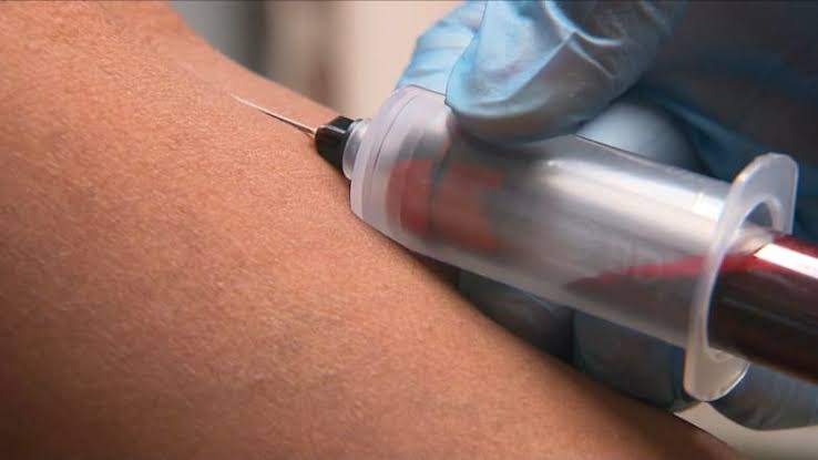 الدم مفتاح جديد لفهم الزهايمر