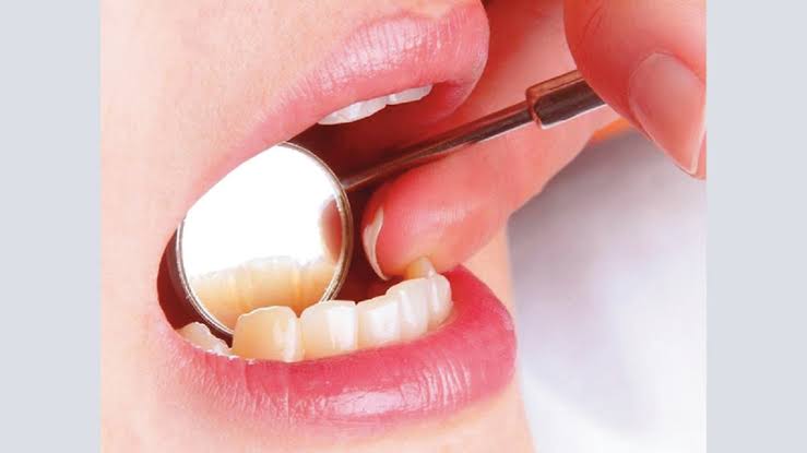 إهمال صحة الفم يهدد القلب والسكري