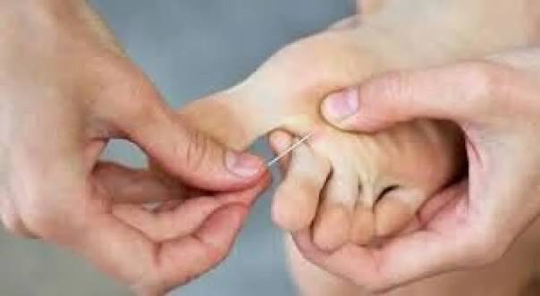 الشظايا إصابة يومية مؤلمة