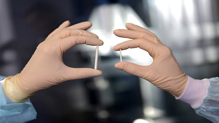 تقنية جديدة آمنة لتثبيت العظام المعقّدة