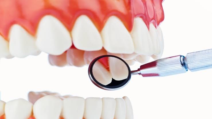لماذا يربط الباحثون بين الأدوية وصحة اللثة؟