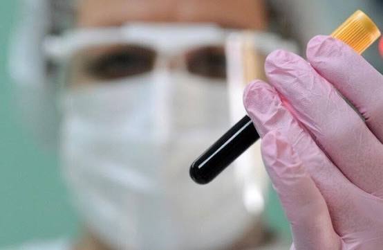 هل يقترب العالم من جائحة جديدة؟