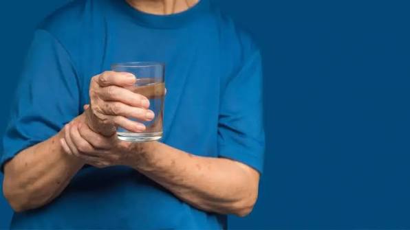 هل يختلف باركنسون بين الرجال والنساء؟