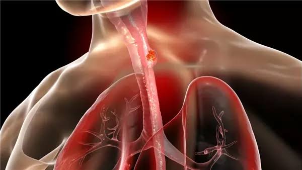 هل يفتح المريء المعملي بابًا جديدًا لعلاج الأطفال؟