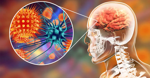 لماذا يظل التهاب السحايا قاتلًا رغم التطعيم؟