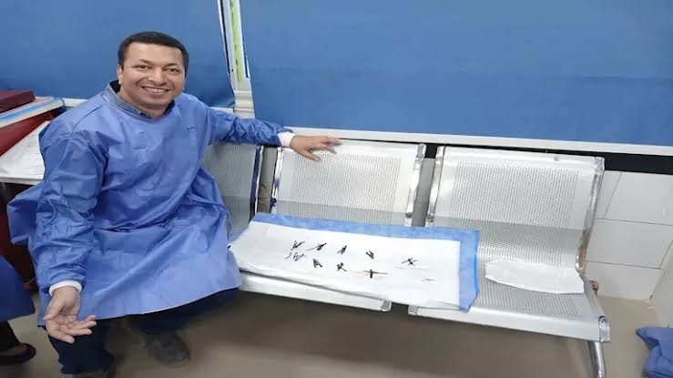 أطباء بني سويف ينقذون مريضاً من 100 مسمار
