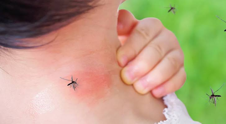 حَك لدغة البعوض يضاعف الالتهاب