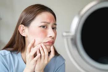 انتفاخ الوجه صباحًا.. عادات يومية قد تكون السبب